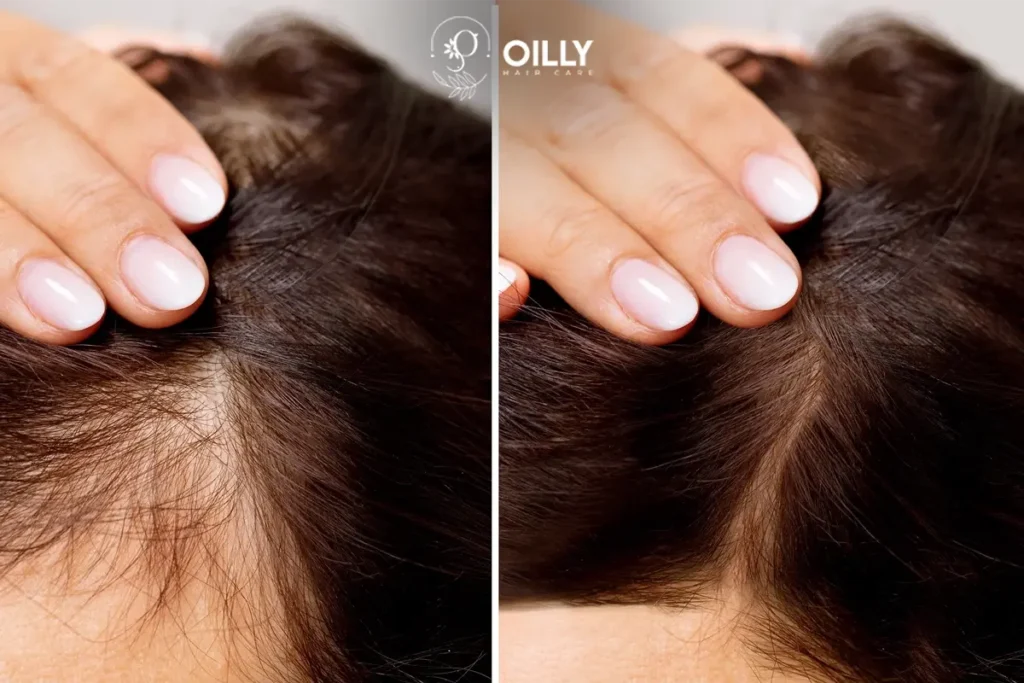 reduce thin hair and get best hair weight and texture