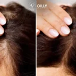 reduce thin hair and get best hair weight and texture
